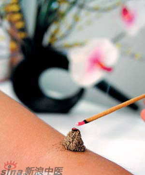 節(jié)氣灸” 冬至，你灸了嗎？