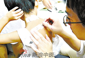 灸法的種類  你知道多少？