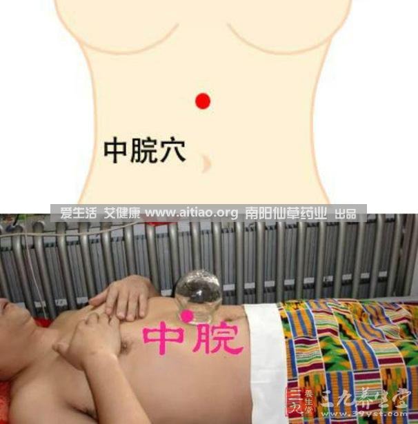 中脘穴位于腹部正中線，臍上4寸的位置上。每天艾灸10-15分鐘，能有效緩解胃部不適的癥狀，同時有助于祛濕。